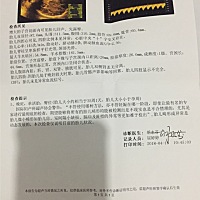 32周开始宝宝脐带绕颈一周 37周终于自己绕出来了 但是还是臀位 这两天每天早晚在做下犬式 期待下次产检...