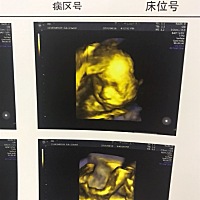 四维出来了。能看出男孩女孩嘛