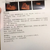 医生说正常。不知道那些指标说明了什么……懂的评论评论😄