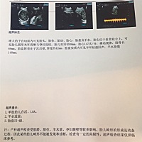 怀孕34周，现在胎盘二级➕，谁懂？