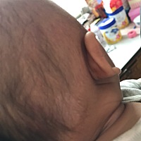 为母则强 宝宝85天 后脑勺头皮上有一小块白色 麻烦大家帮忙看看有知道的吗？ 谢谢了