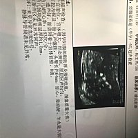 NT顺利通过哦，谁能看出男宝女宝呀