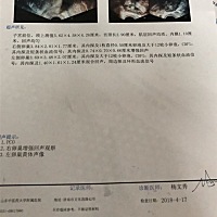 我一直多囊，昨天去看医生，医生告诉我一个星期后没来月经继续测试早孕，我当时也没多想，因为感觉怀孕...