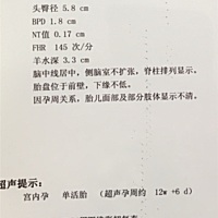 有经验的宝妈们 帮我看看男孩还是女孩  蟹蟹🍒🌽🍇🍓🥦🥕