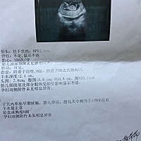 那位好心人帮忙看看是男是女