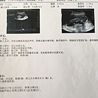 宝妈们 这个可以看得出来是男宝还是女宝吗？着床于前壁性生活有影响吗？看不懂是15周＋几天呢