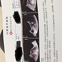 有经验的姐妹们帮忙看一下，一切都正常吧🙏