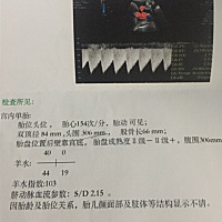 哪位大神能看出来是男孩还是女孩？全部的B超单😃