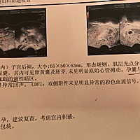 有经验的帮我看看这是6周多点才做的b超，能从图片看出男女吗？娱乐一下