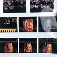 四维照了六七次可算拍好了，宝宝们会看男宝女宝吗？就是好奇