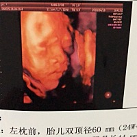 四维通过。好奇男宝女宝。 感觉好丑呀