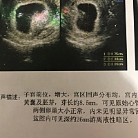 38*23*31，49天做的B超，是女孩吗？