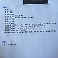 37周了。这样能看出来是男孩女孩吗
