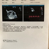 还有两个月就生了，还是很好奇男宝女宝😄有看懂的嘛，希望大家帮忙看看！