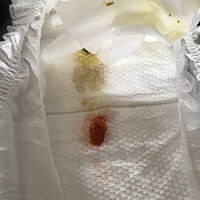 有宝宝拉粑粑里面有血的宝妈吗。去医院检查，医生就让我们买了益生菌来吃，来了3瓶搽屁股的药