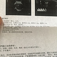 今天检查出来羊水偏少，明天要住院了。医生说甜食吃太多会导致羊水偏少