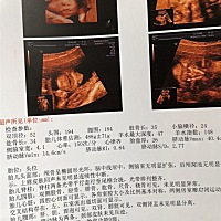 四维出来了，能看男女不