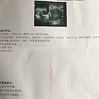 3月5日末次月经，今天去拍彩超，说没有明显孕囊，排b超的医生说位置可能不好。另外医生看了，叫我过十天...