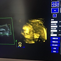 看的清楚吗？猜猜男孩女孩！