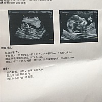 求各位姐妹帮忙看看男女，目前育有两个女孩了，想凑个好字，谢谢各位