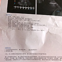 孕39w 1了还不发动，求发动！求有经验的宝妈赐发动妙招啊！🙏🙏