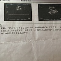 哪位大神看不看的出是男宝还是女宝呀？二胎了，谢谢啦