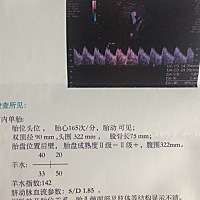 二胎了   头胎男孩  叫刘昊城   二胎是女孩的话就叫刘恩惜   希望以后懂得感恩  珍惜来到这个世界的每分...