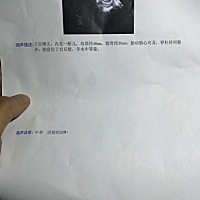 请各位帮忙看看是男孩还是女孩