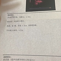 帮忙看看男女 大神们 不知道能看出来吗？