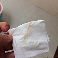 这算见红吗？看似血丝的样子，不懂，刚刚才发现，肚子不痛现在