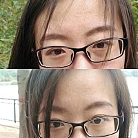 之前  闭口  痘痘  斑点  整个脸部看起来真的让人很不舒服    朵颜4瓶后  直接就像换脸一样   之前的问...