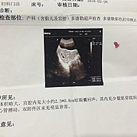 各位亲这是怀孕45天的B超单，能看出男宝女宝吗？