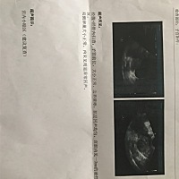 3.6末次月经。4.3同房。4.14发现怀孕。4.19做的阴超。这是宫内的吧？医生说宫外什么都没看到……