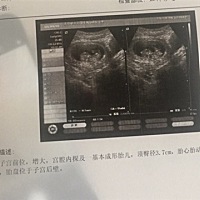 第一次看到这样的宝宝，被她（他）萌化了。