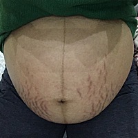 再不生肚子花的没法看了。有会看男宝还是女宝的嘛？