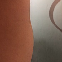 鼓起来的地方是什么地方，这几天一直不舒服，我希望好孕！排卵期刚同房，这几天肚子胀气～难道因为我胖...