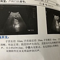 孕七周第一天～三四天前开始头痛……半夜醒～虽然说是正常反应……怎么缓解啊……😭