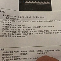 昨天内检宫口开一指，昨晚没感觉疼，今天还没去检查，3分钟痛一次，一次痛10秒，不是特别疼，酸疼的那种...