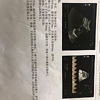 今天见红了，准备去找医生，不知道是男宝还是女宝呢，好期待哦