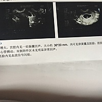 有会看男宝女宝的么？实在好奇，求知识😊