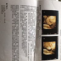 今天见红了，好紧张哦，之前照了两次是女宝，但是每个人看我的肚型都说是男娃，好期待好想知道，虽然男...