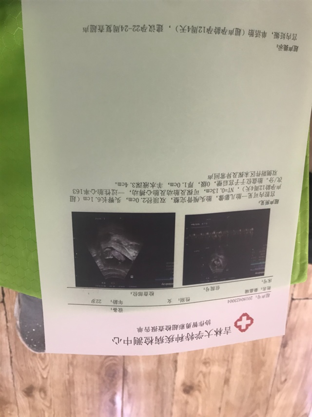 帮我看看正常吗？还有是男孩女孩？万分感谢