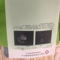 帮我看看正常吗？还有是男孩女孩？万分感谢