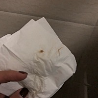 刚刚上厕所发现这个，是先兆流产德表现吗