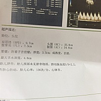 都不知道多大，都没有写娃娃多重