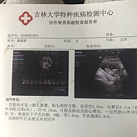 帮我看下是男孩女孩👧好奇心超强，十分感谢宝妈们