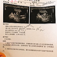 有没有会看这个比超单子的？好奇是男孩女孩😁😁