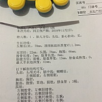 NT顺利通过，亲们看看男宝女宝