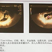 不知道是男孩还是女孩呢？