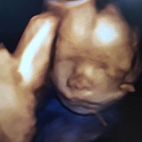 能看出男孩女孩吗？